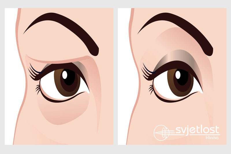 Do you know which aesthetic surgery procedure is the most common nowadays?