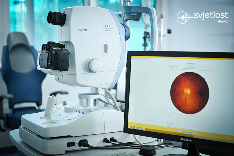 Do you know what yellow spot or macula is?